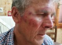 Απίστευτο: Τούρκοι έδειραν 73χρονο Έλληνα στη Σάμο επειδή άκουγε εκκλησιαστική λειτουργία