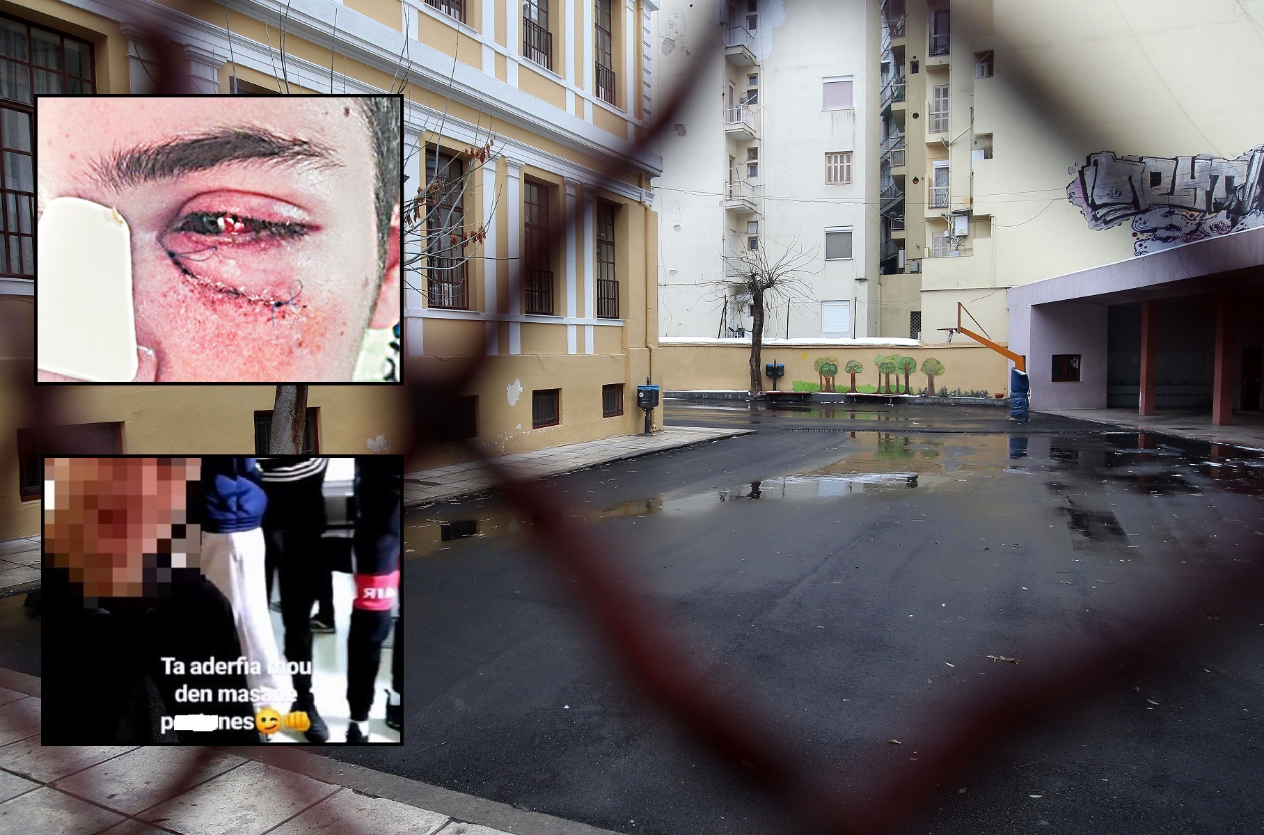 Ξυλοδαρμός 17χρονου στον Βύρωνα: “Χτυπούσαν από τον αυχένα μέχρι το κεφάλι”