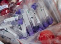 Έλληνας καθηγητής κορωνοϊός: «Πιθανόν τα κρούσματα στην Ελλάδα να είναι έως και 200.000 Έλληνας καθηγητής κορωνοϊός: «Πιθανόν τα κρούσματα στην Ελλάδα να είναι έως και 200.000