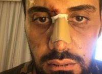 Ρατσιστική επίθεση: Τουρίστας το θύμα – Καταγγέλλει τις αρχές για μεροληπτική συμπεριφορά Ρατσιστική επίθεση: Τουρίστας το θύμα – Καταγγέλλει τις αρχές για μεροληπτική συμπεριφορά
