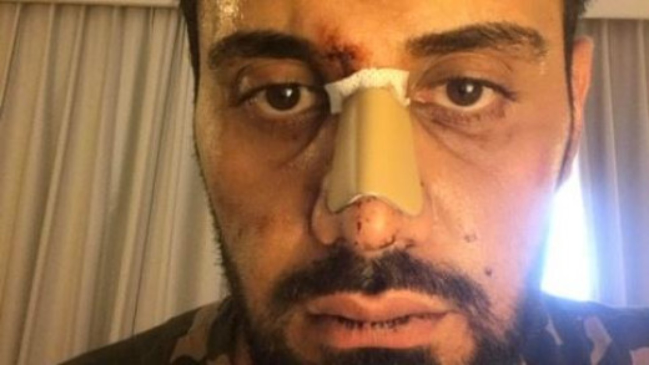 Ρατσιστική επίθεση: Τουρίστας το θύμα – Καταγγέλλει τις αρχές για μεροληπτική συμπεριφορά