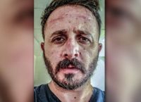 Γιατρός ΠΑΓΝΗ: Γκρινιάζετε για τη μάσκα και εμείς παρακαλάμε να έχουμε κάθε μέρα ώστε να δουλεύουμε