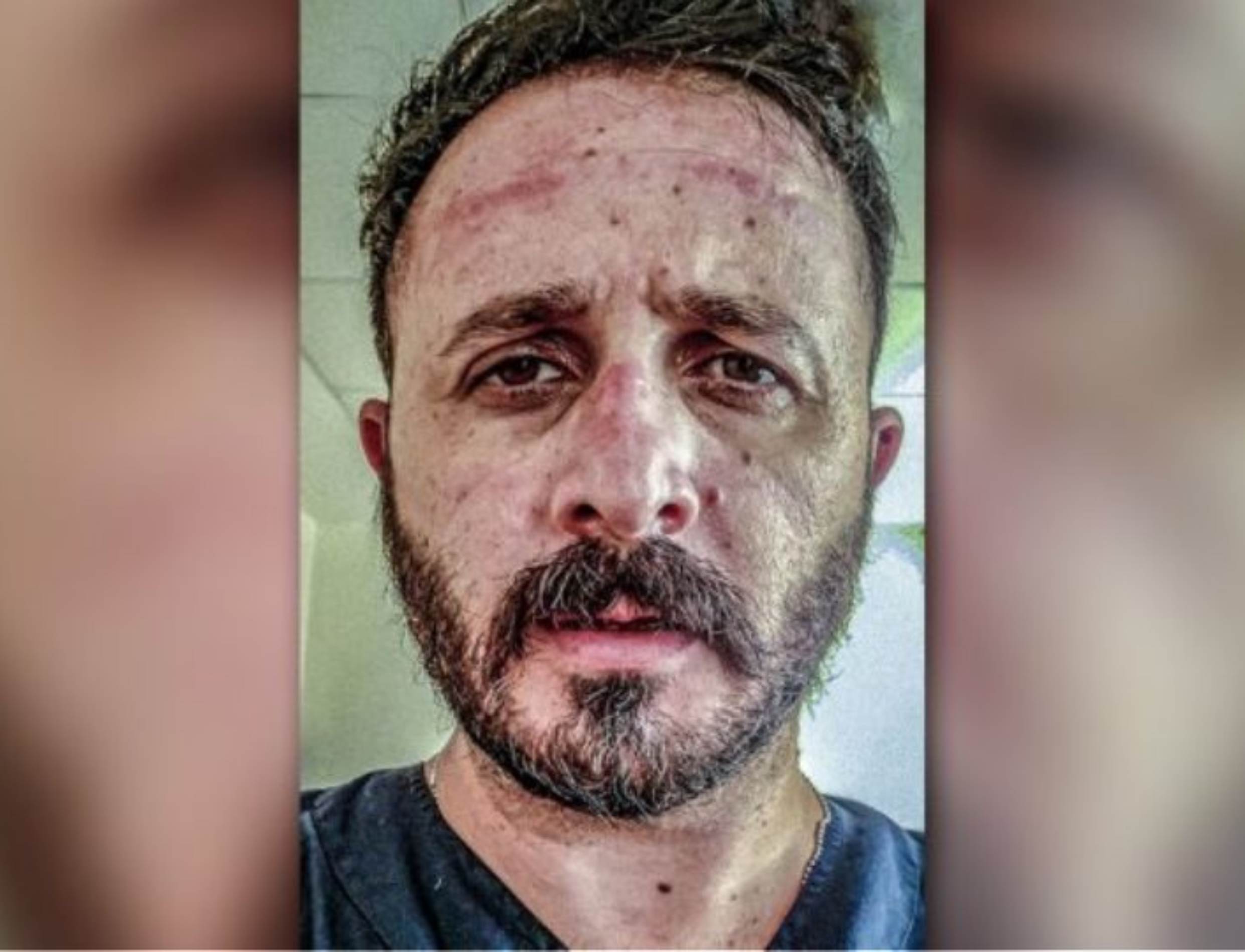 Γιατρός ΠΑΓΝΗ: Γκρινιάζετε για τη μάσκα και εμείς παρακαλάμε να έχουμε κάθε μέρα ώστε να δουλεύουμε