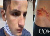 Ξυλοδαρμό 17χρονου: Αιματηρή επίθεση από 20 ανήλικους – Τον χτυπούσαν με μανία επί 10 λεπτά Ξυλοδαρμό 17χρονου: Αιματηρή επίθεση από 20 ανήλικους – Τον χτυπούσαν με μανία επί 10 λεπτά