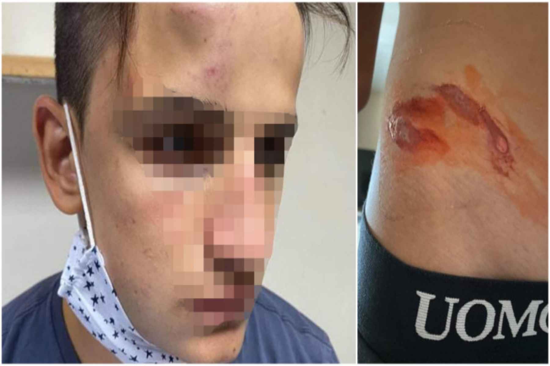 Ξυλοδαρμό 17χρονου: Αιματηρή επίθεση από 20 ανήλικους – Τον χτυπούσαν με μανία επί 10 λεπτά