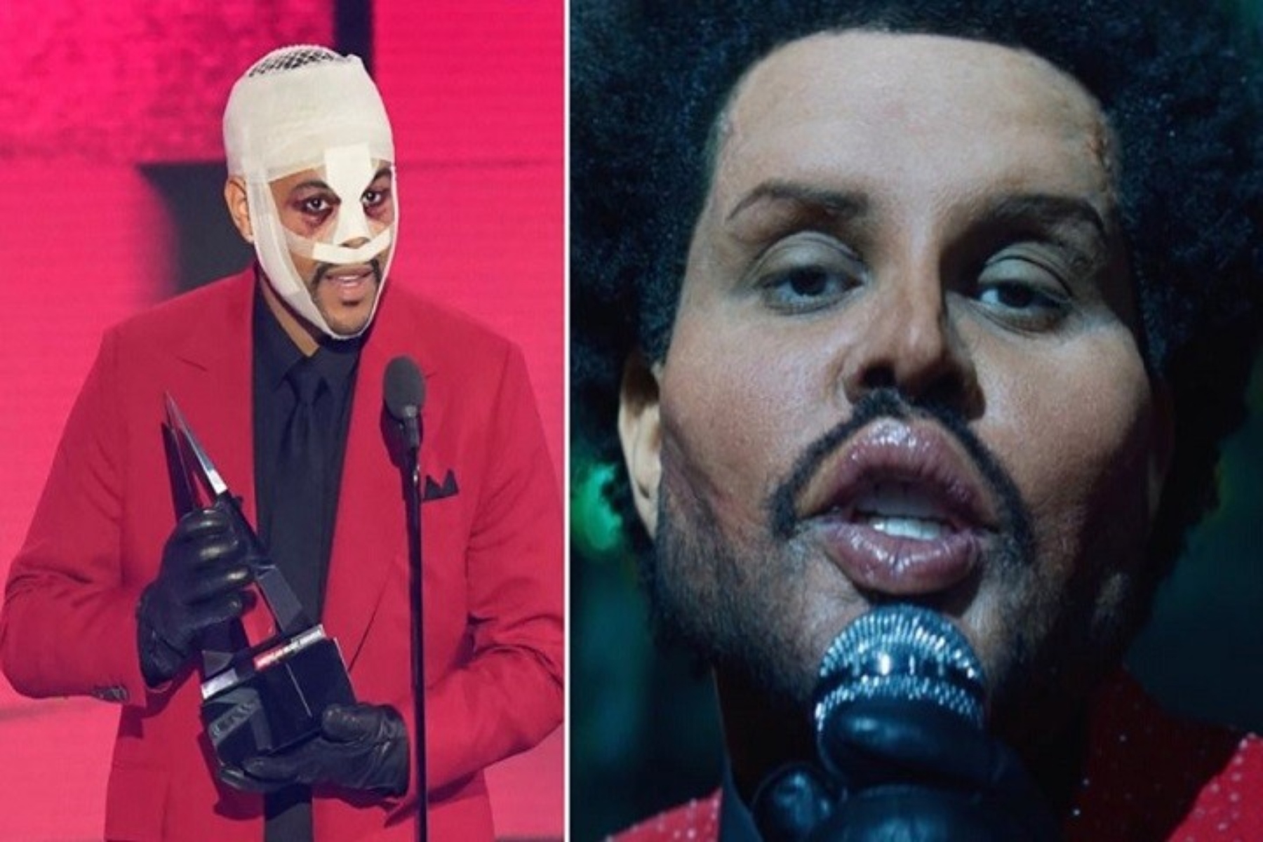 The Weeknd: Εμφανίζεται με παραμορφωμένο πρόσωπο στο video του «Save Your Tears»