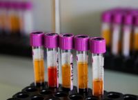 Μονοκλωνικά αντισώματα: Παρέλαβε 2.000 δόσεις η Ελλάδα