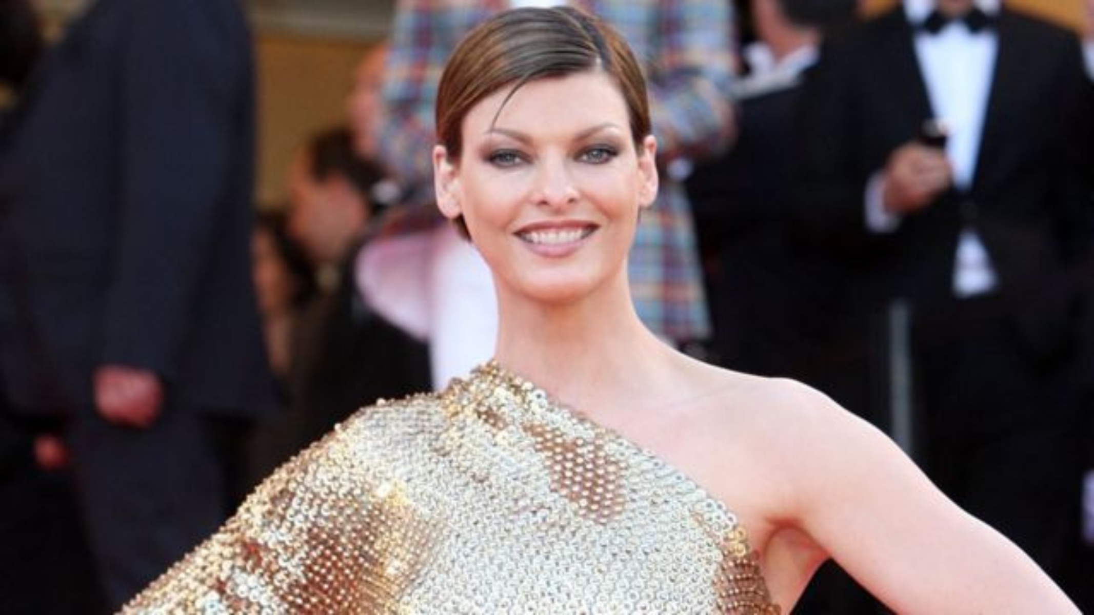 Linda Evangelista: Η παραμόρφωση μετά από επιπλοκή σε συνεδρία κρυολιπόλυσης