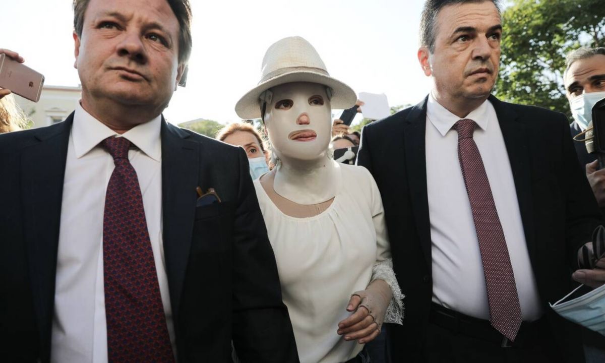 Επίθεση με βιτριόλι: Οργή από την Ιωάννα για τους ισχυρισμούς του 40χρονου