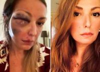 Στεφανία Τζαφέρη: Οργή για μηνύματα που δέχεται μετά τον ξυλοδαρμό της