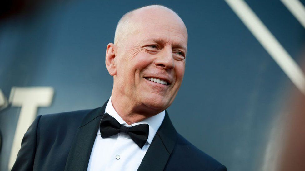 Ο Bruce Willis ανακοίνωσε το τέλος της καριέρας του για λόγους υγείας – Η ασθένεια από την οποία πάσχει