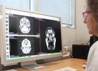 Την έλευση μιας νέας εποχής θεραπειών για την Αλτσχάιμερ χαιρετίζουν ερευνητές