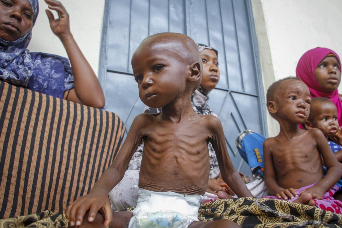 UNICEF: Εκατομμύρια παιδιά στην Υεμένη πεθαίνουν από ακραίο οξύ υποσιτισμό λόγω έλλειψης κεφαλαίου
