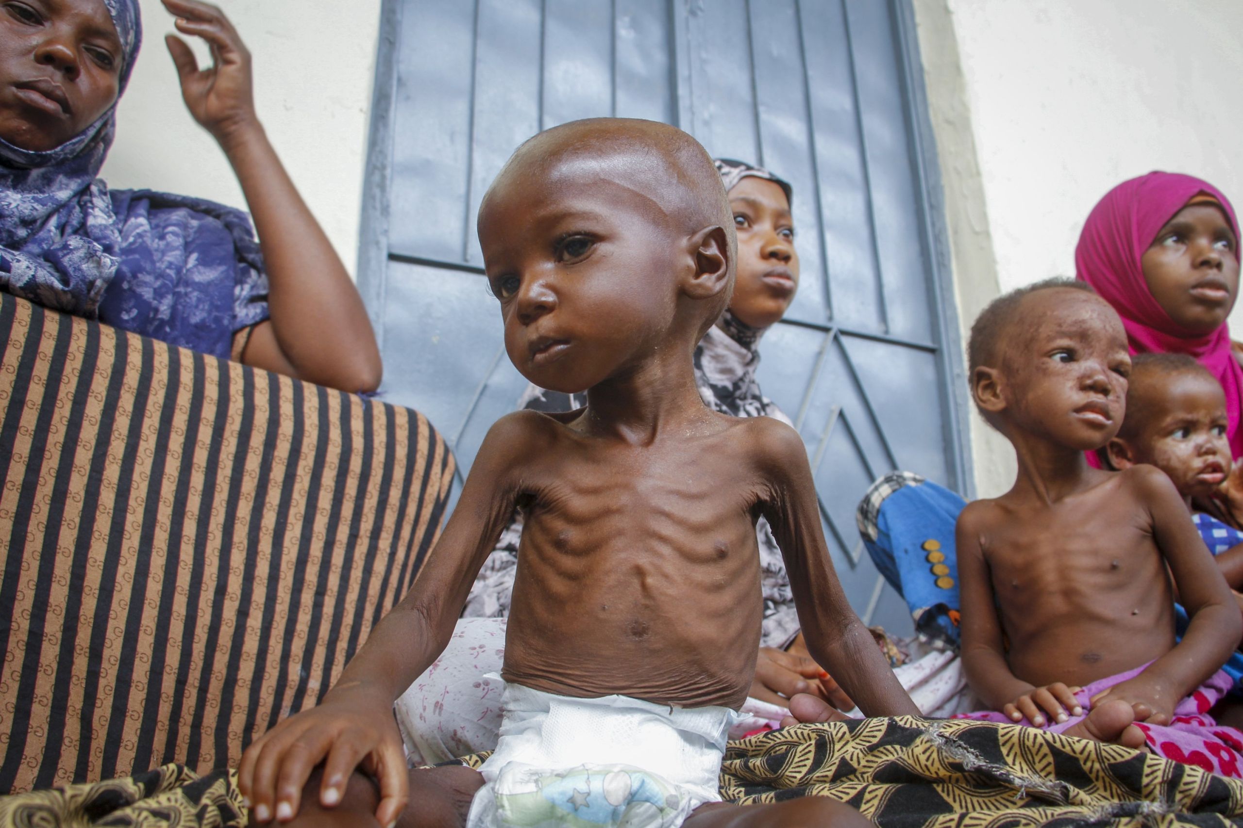 UNICEF: Εκατομμύρια παιδιά στην Υεμένη πεθαίνουν από ακραίο οξύ υποσιτισμό λόγω έλλειψης κεφαλαίου
