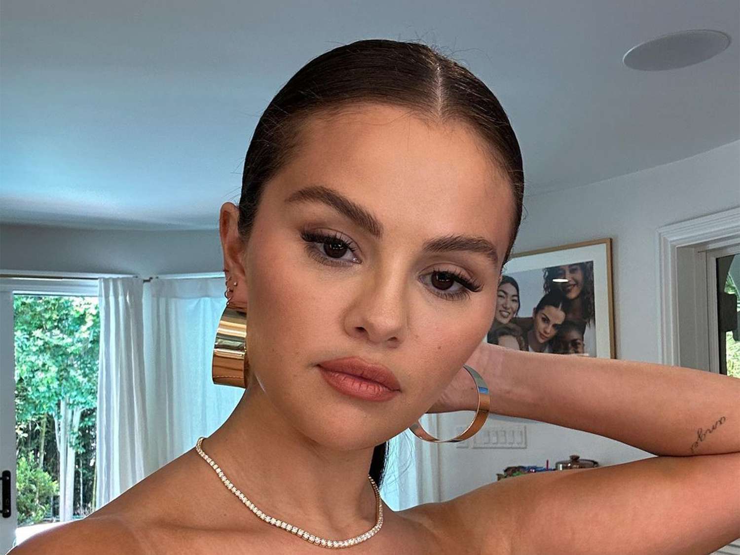 Selena Gomez: Μπήκε για χειρουργείο μετά το σπάσιμο του χεριού της