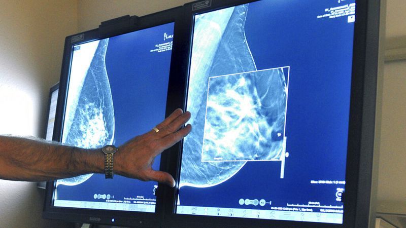Βρετανία: Επιστήμονες ανέπτυξαν τεστ που διαγιγνώσκει τον καρκίνο του οισοφάγου σε 30 δευτερόλεπτα