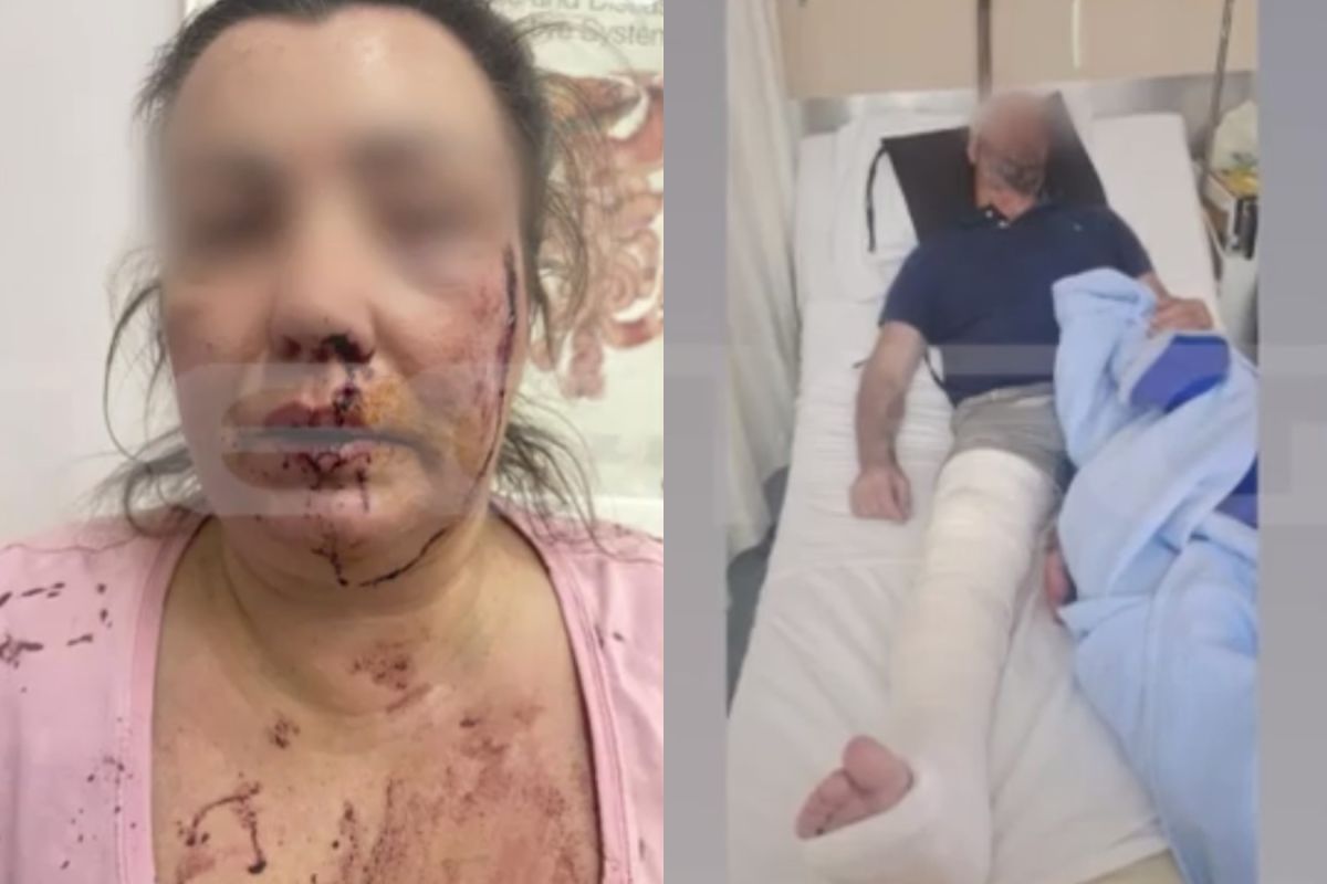 Αιγάλεω: Ζευγάρι έπεσε θύμα άγριου ξυλοδαρμού μέρα μεσημέρι στην Πέτρου Ράλλη