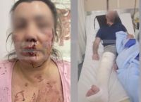 Αιγάλεω: Ζευγάρι έπεσε θύμα άγριου ξυλοδαρμού μέρα μεσημέρι στην Πέτρου Ράλλη