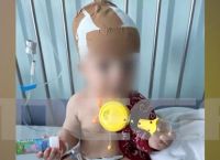 Σκύλος δάγκωσε στο κεφάλι 11 μηνών αγοράκι την ώρα που το τάιζαν οι γονείς του