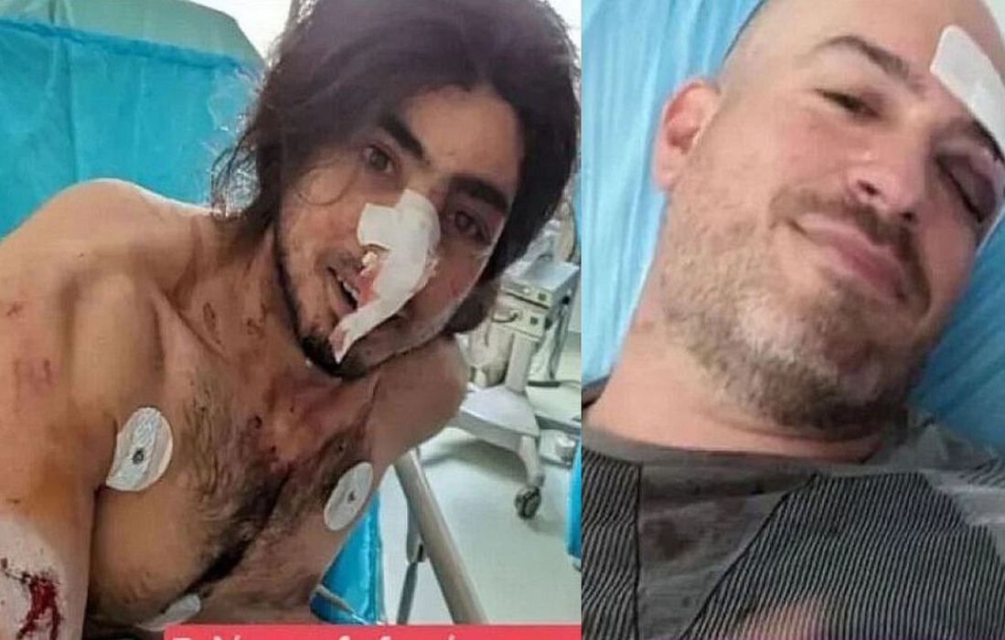 «Ήταν επτά άτομα και μας χτύπαγαν» – «Έχασα πολύ αίμα»: Συγκλονίζουν οι εθελοντές της Πάρνηθας