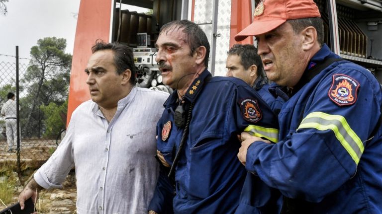 Φωτιά στο Σοφικό: Υποβασταζόμενος ο πυροσβέστης που τραυματίστηκε [pic]