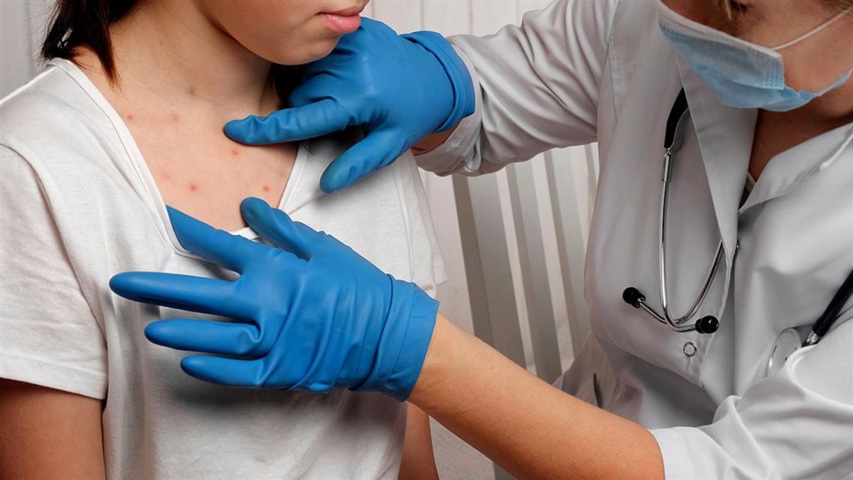 Mpox: «Στον ύπνο» πιάστηκε και πάλι η παγκόσμια κοινότητα