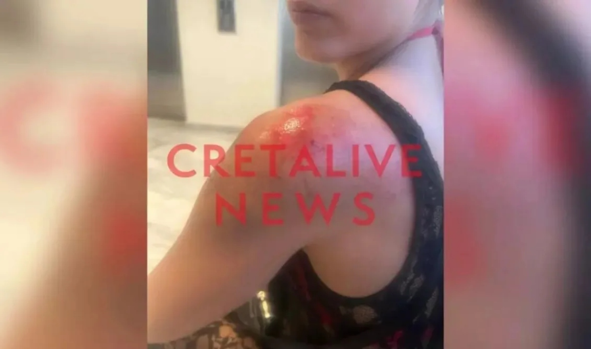 Εφιαλτικές στιγμές για 25χρονη στο Ηράκλειο: Την φωτογράφισε κρυφά,την χτύπησε με μηχανάκι και την έσυρε