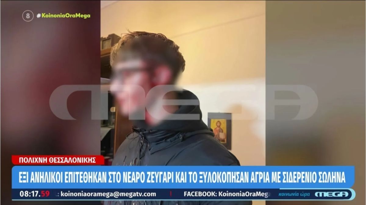 Θεσσαλονίκη: Σοκάρει η φωτογραφία του 16χρονου που δέχτηκε επίθεση από ομάδα ανηλίκων–«Ήταν μέσα στα αίματα»