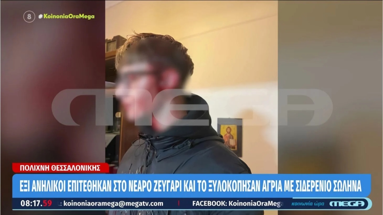 Θεσσαλονίκη: Σοκάρει η φωτογραφία του 16χρονου που δέχτηκε επίθεση από ομάδα ανηλίκων–«Ήταν μέσα στα αίματα»