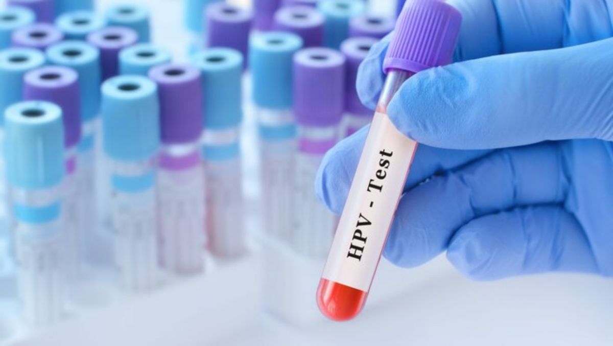 Λοίμωξη HPV και καρκίνος στοματοφάρυγγα – λάρυγγα