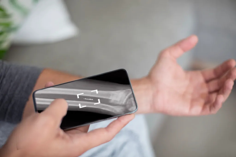 Θα ανιχνεύουν καρκίνο μέσω iPhone; – Το νέο ελπιδοφόρο gadget