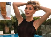 «Πίστεψα ότι θα πεθάνω»: Influencer δείχνει τα τραύματά της μετά την αθώωση του πρώην της για άγρια επίθεση «Πίστεψα ότι θα πεθάνω»: Influencer δείχνει τα τραύματά της μετά την αθώωση του πρώην της για άγρια επίθεση