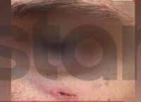 14χρονος ξυλοκοπήθηκε από επτά συμμαθητές για μια λάθος πάσα στο μπάσκετ 14χρονος ξυλοκοπήθηκε από επτά συμμαθητές για μια λάθος πάσα στο μπάσκετ