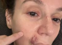 Σοκ! Με μαυρισμένο μάτι και αίματα στο πρόσωπο η Πέγκυ Τρικαλιώτη- Τι συνέβη [pics]