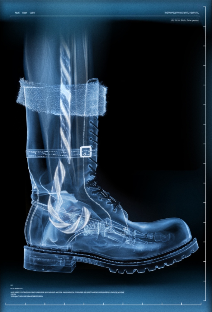 Τραυματίας ο Αϊ-Βασίλης! Σε κίνδυνο τα Χριστούγεννα;