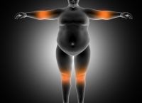 Lancet: Η παχυσαρκία αυξάνει έως 70% τον κίνδυνο για βαριές λοιμώξεις