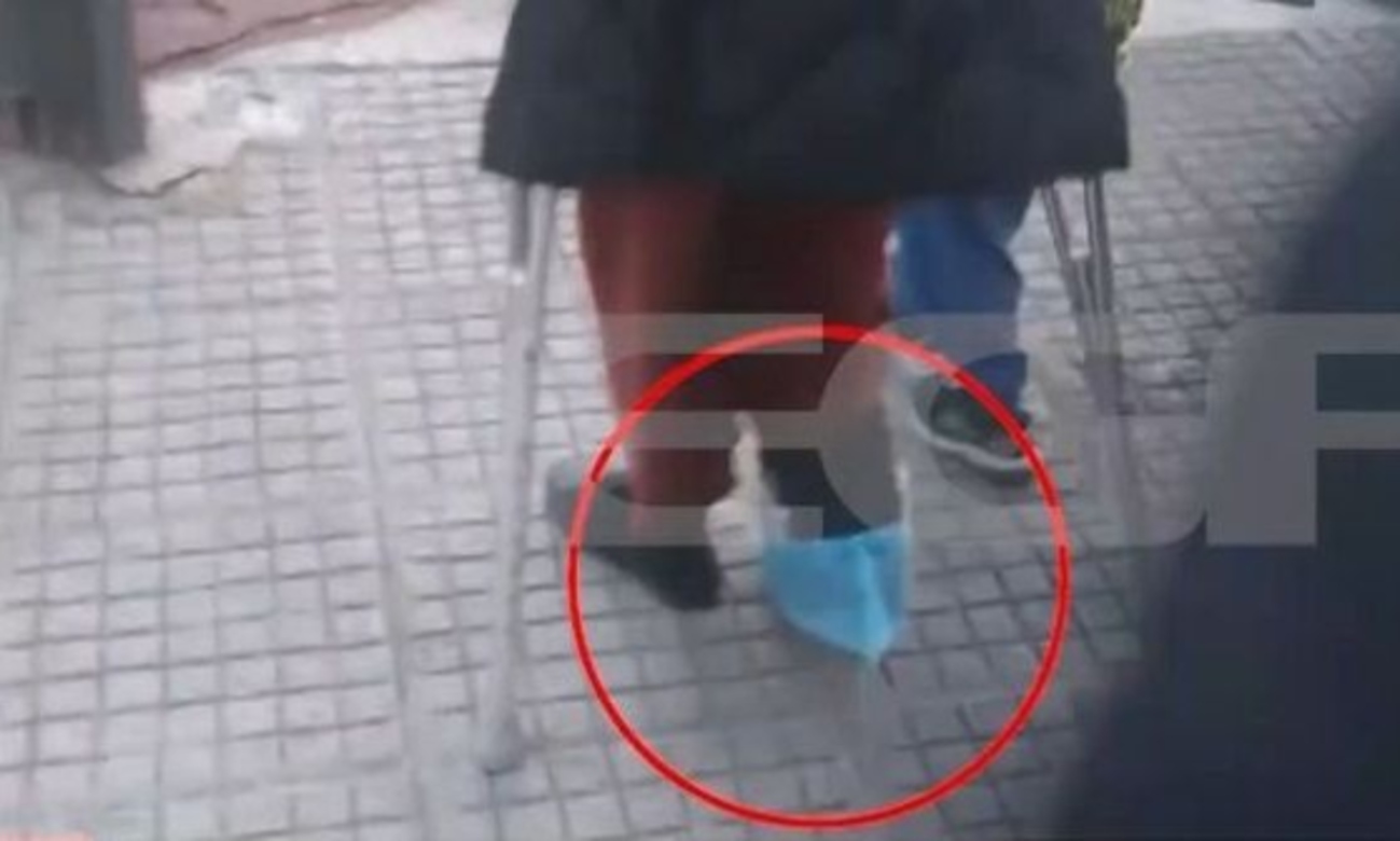 Ζωγράφου: Νηπιαγωγός πήγε στο σχολείο με γύψο και πατερίτσα για να μην χάσει τη θέση της [vid]