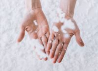 Έχετε κρύα χέρια; Αυτοί είναι οι λόγοι – Τι αποκαλύπτουν οι «αρκτικές θερμοκρασίες» στα άκρα