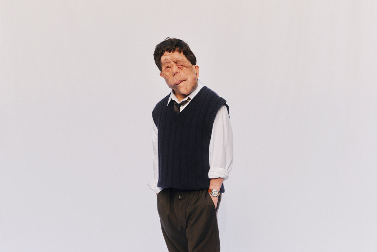 Άνταμ Πέρσον: Η λάμψη της διαφορετικότητας που ξεχώρισε στα Όσκαρ