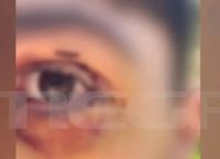 Ιωάννινα: Έστησαν καρτέρι σε 16χρονο τον ξυλοκόπησαν άγρια και κινδύνευσε να χάσει την όρασή του [vid]