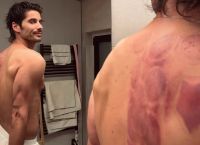 Σόκαρε ο Καράβας -Αποκάλυψε το πρόβλημα που έχει στην ωμοπλάτη