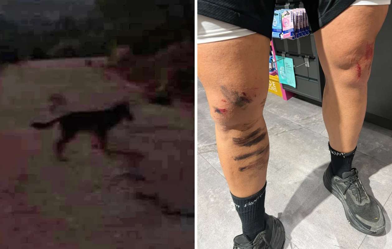 Άγρια επίθεση λύκου σε κάτοικο στο Κρυονέρι, «έπεσε πάνω μου και με δάγκωσε» [vid]