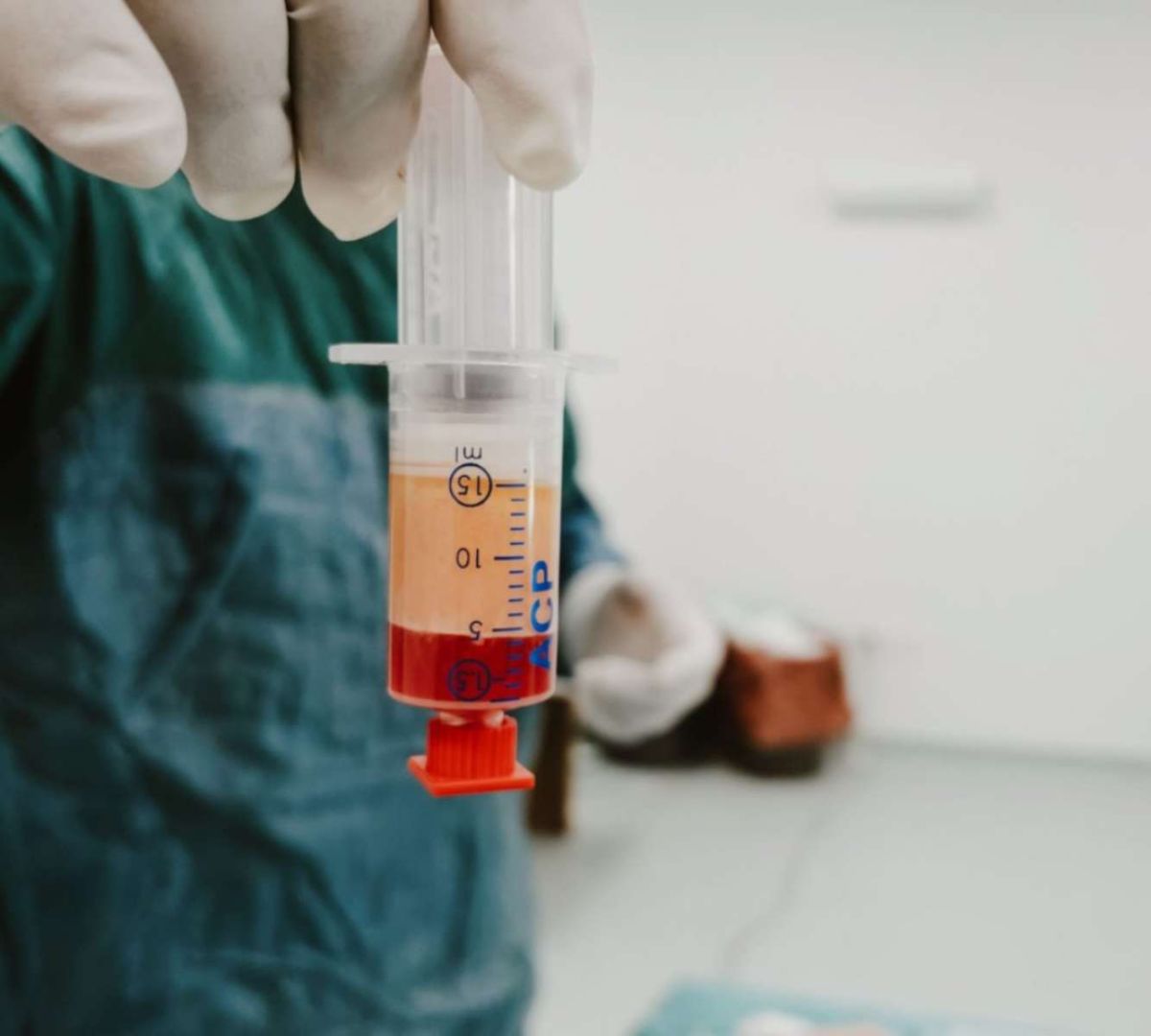 Πλασμαφαίρεση: Τι είναι η θεραπεία που έκανε ο Μαζωνάκης πριν από την ανακοπή