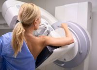 Καρκίνος μαστού: Το χάπι της Roche που μειώνει 30% τον κίνδυνο υποτροπής – Η μεγάλη ανατροπή στην ογκολογία