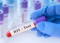 AIDS: Οι επιστήμονες μαθαίνουν να ελέγχουν τον HIV χωρίς φάρμακα – Η μελέτη που μπορεί να αλλάξει τα δεδομένα