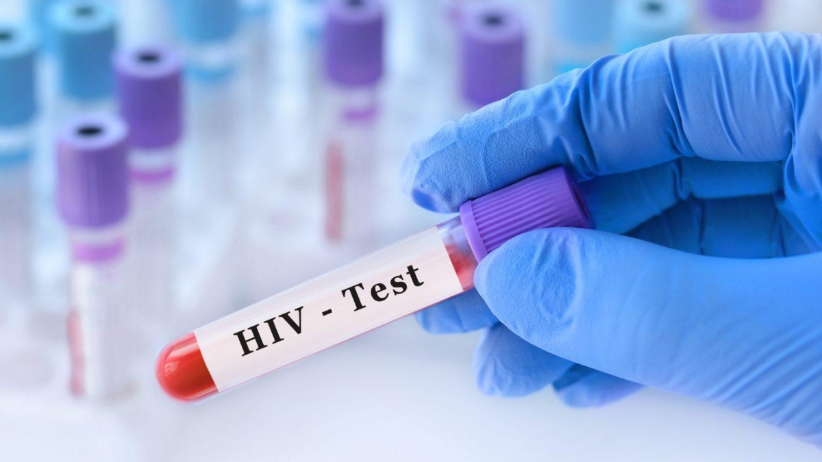 AIDS: Οι επιστήμονες μαθαίνουν να ελέγχουν τον HIV χωρίς φάρμακα – Η μελέτη που μπορεί να αλλάξει τα δεδομένα